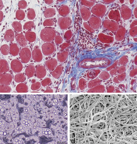 extracellular matrix